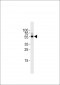 TGF Beta 2 Antibody (C-term)